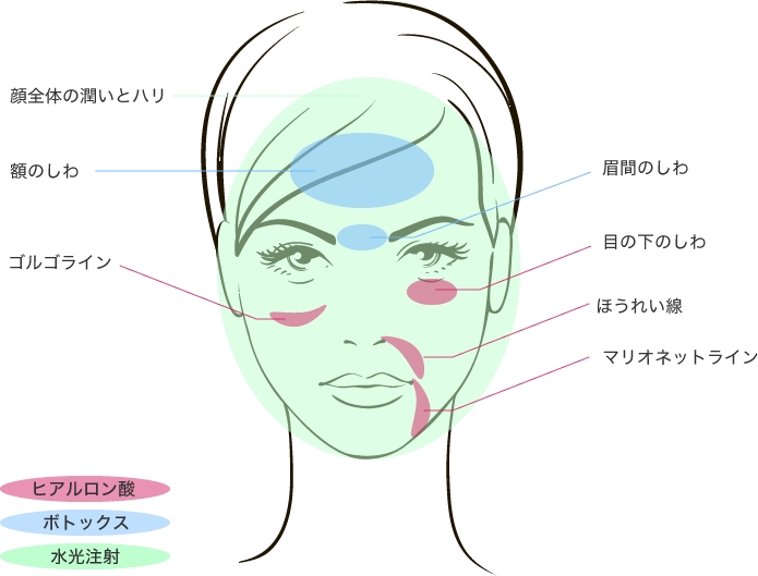画像4: 手軽に通えるヒアルロン酸・ボトックス・BNLSの専門クリニック誕生!