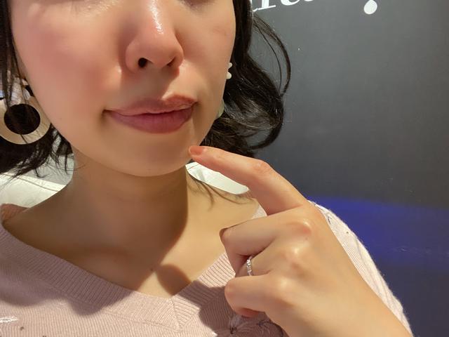 画像1: HydraFacialで小鼻と唇のクレンジング+ピーリングを体験!