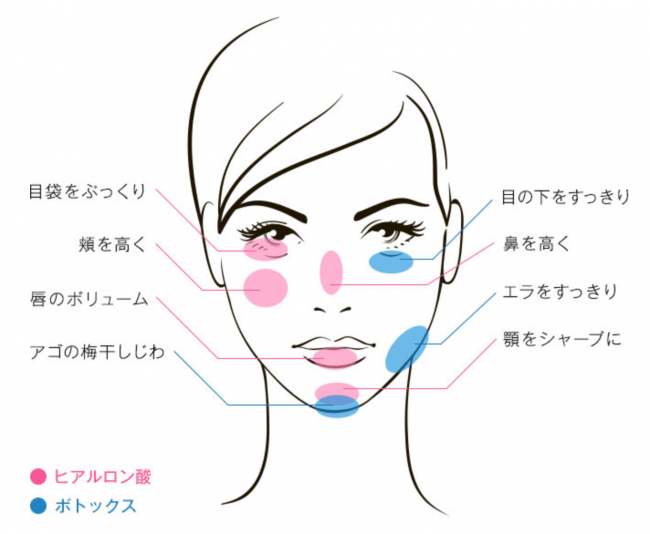 画像2: 注入系プチ整形専門クリニック 「フィラークリニック横浜院」が開院