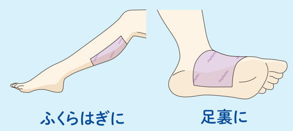 画像: 〈貼り方のコツ〉 貼ってすぐに、シート全体をしばらく上から軽くおさえるとジェルが肌に馴染んでフィットしやすく!