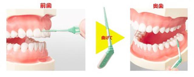 画像: 図1 持ち手上部が曲がるから奥歯をしっかりケアできる