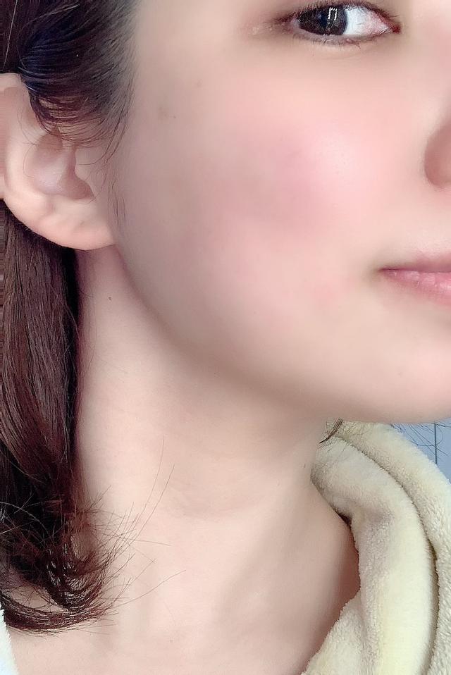画像: 使用後すぐのスッピン肌をパシャリ!肌が本当になめらかでスベスベに♪
