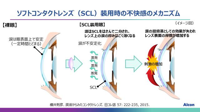 画像1: プレシジョン ワン®️の製品特長