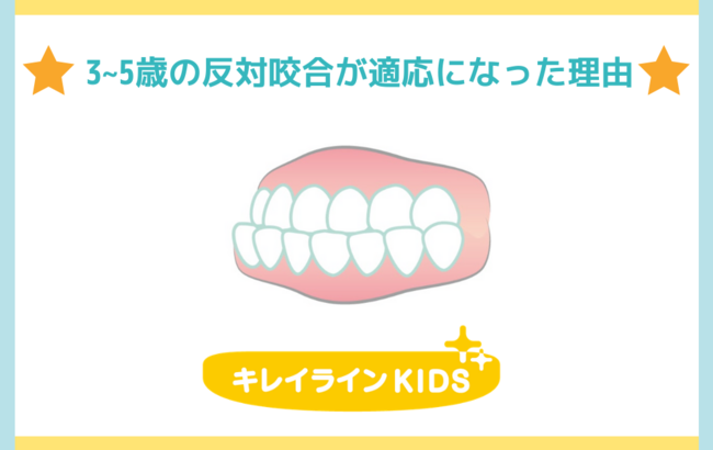 画像1: 「反対咬合（はんたいこうごう）」とは、どのような症状？
