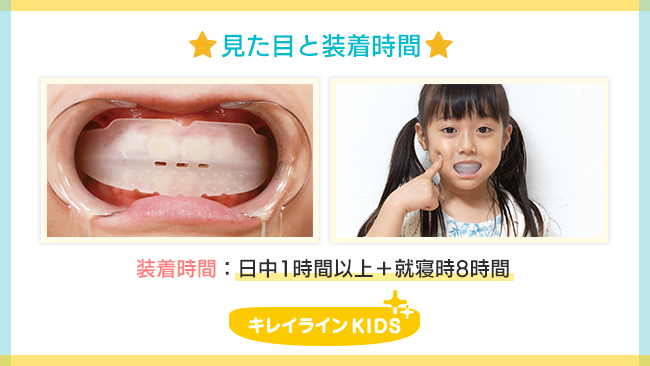 画像: 『キレイラインKIDS』は、どんな治療法？