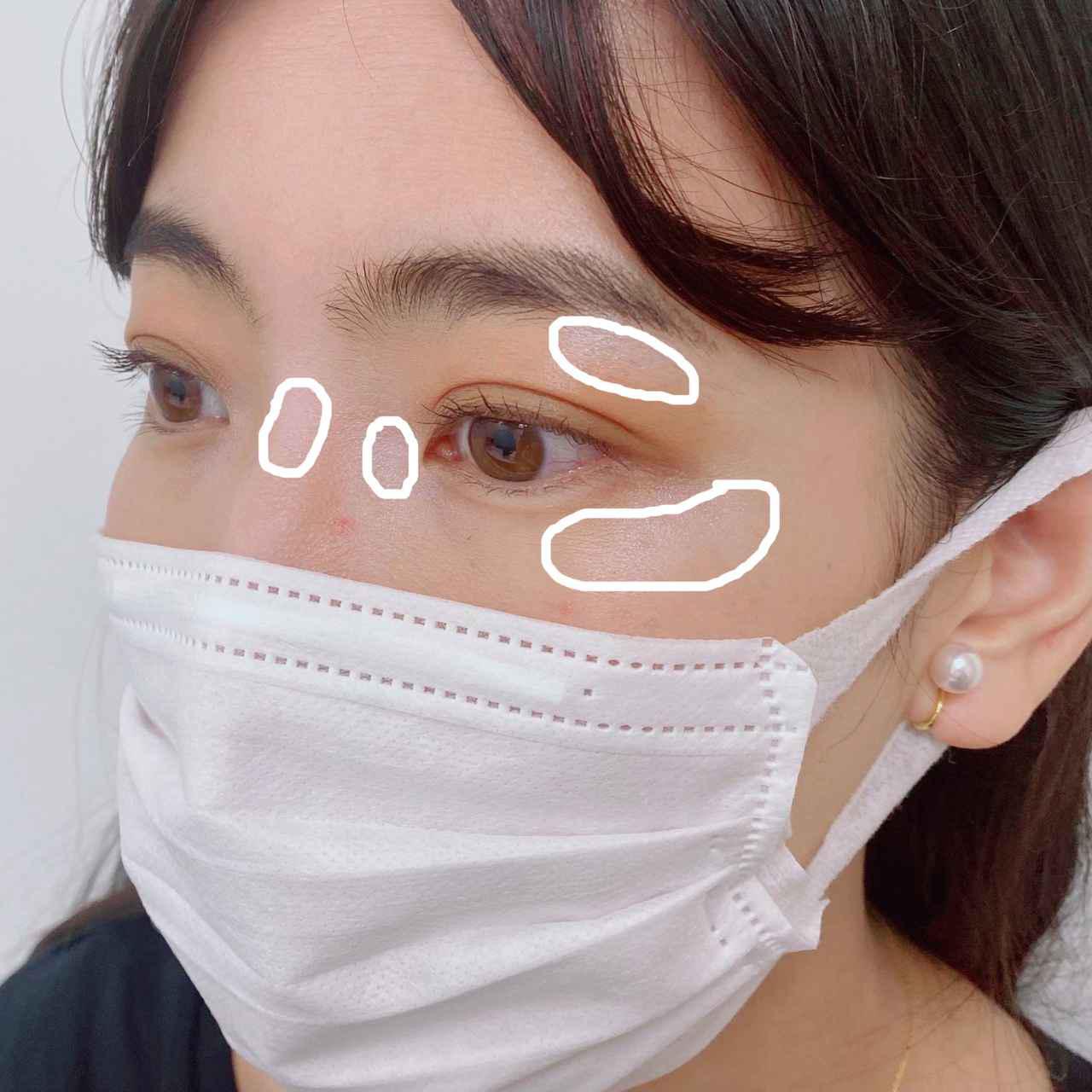画像5: 次のトレンドは“鼻根”?今春頃から “整形術・整形部位メイクテクニック”ワードが出現