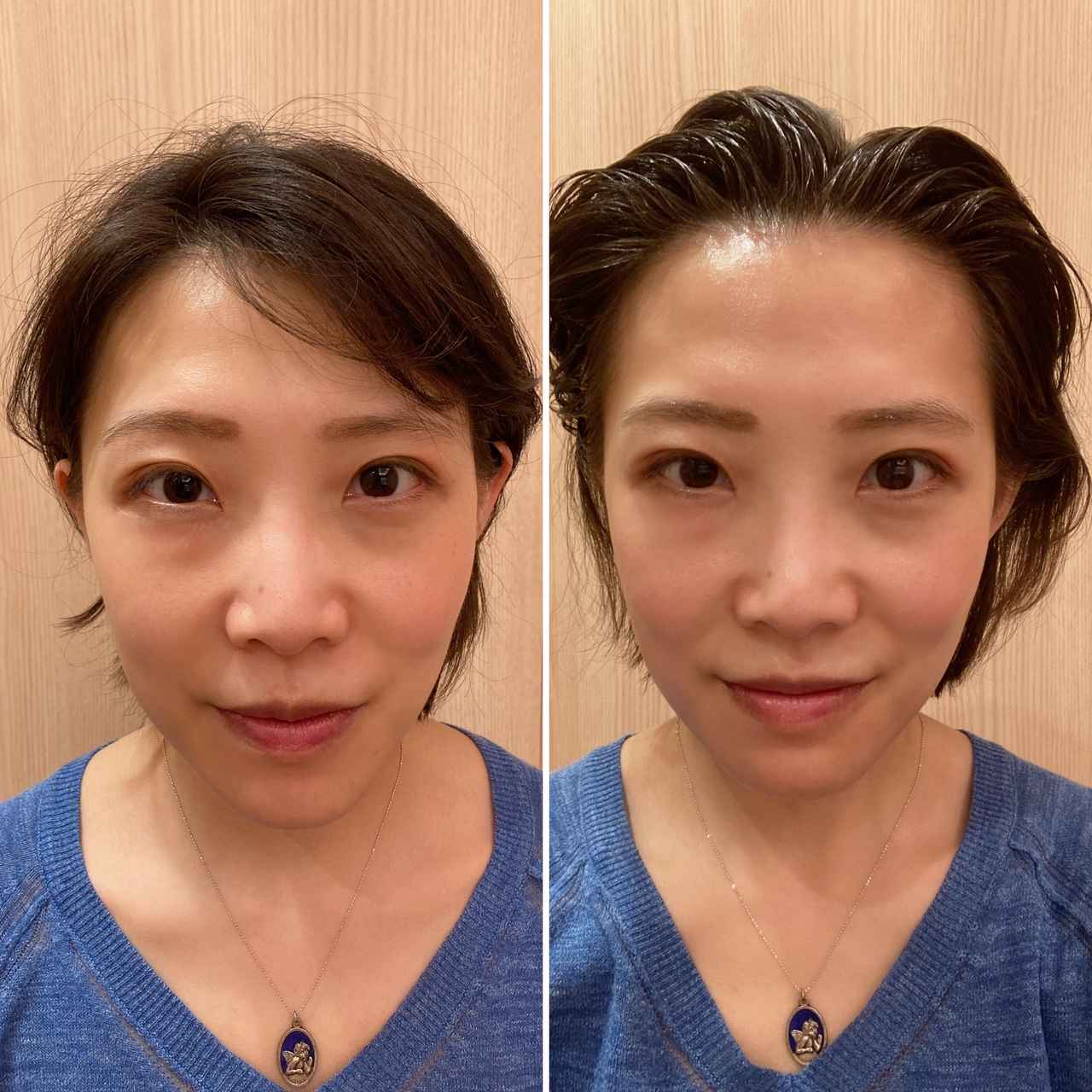 画像: 左が施術前、右が施術後