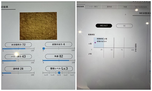 画像2: 【IPSA(イプサ)】が新プロジェクト始動!肌悩みを持つ1,236万⼈を解放させることを⽬指す#素肌からわたしの自信をつくろう