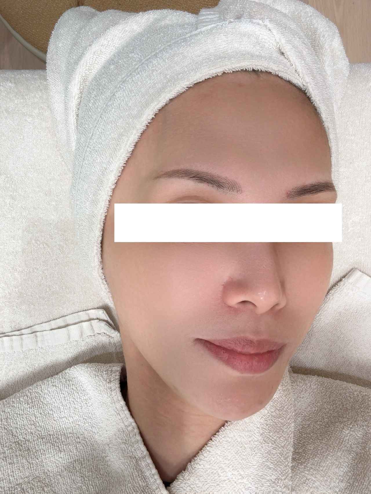 画像15: 肌に必要なのは”戦略”でした♡「ALOOP CLINIC & LAB」で叶える理想の美肌体験