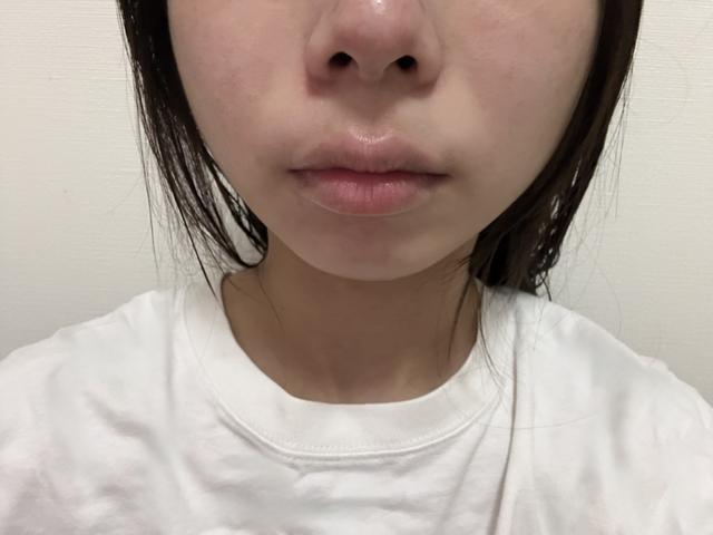使用レポ♡】本格機能のフェイス用美顔器で、美のポテンシャルを