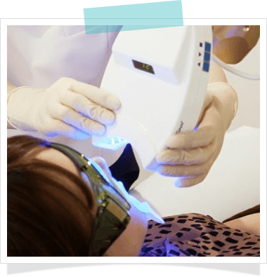 画像: スターホワイトニング｜ホワイトニングがいつでも1回2,950円｜全額返金保証付