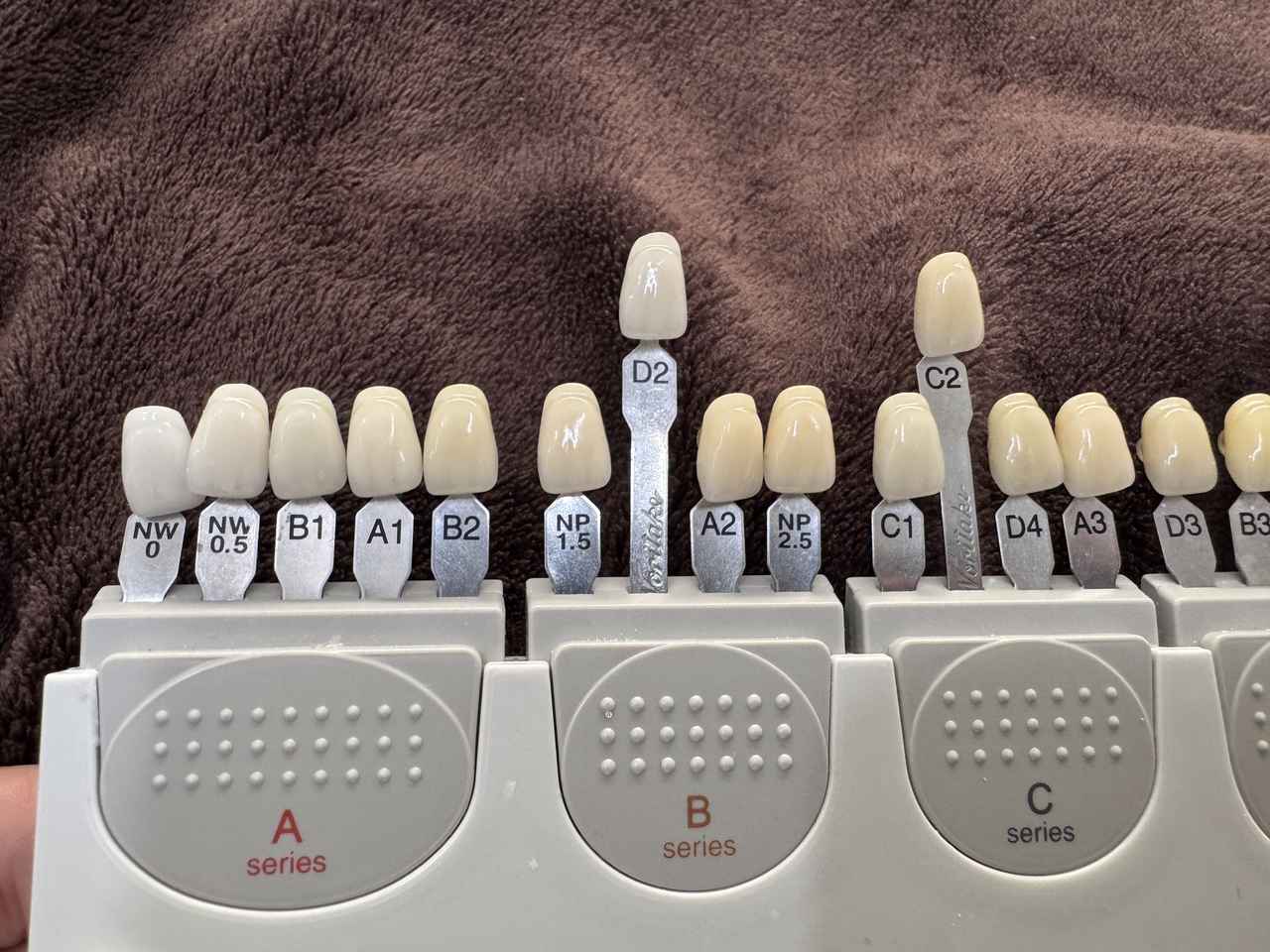 画像: 施術後　C1→D2（3ステップ）、A3→C2（2ステップ）も白さアップ