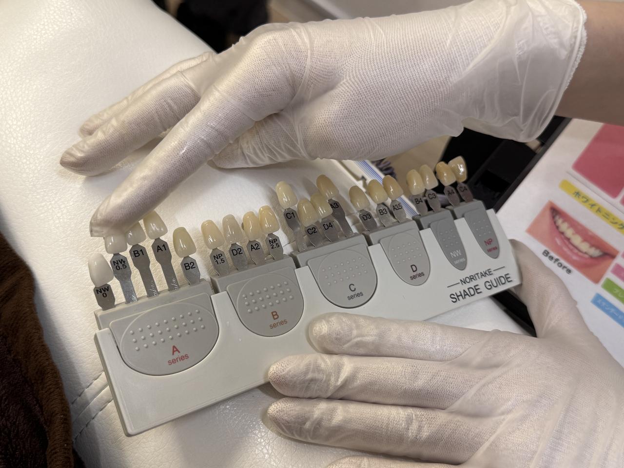 画像1: 驚くほど丁寧なカウンセリング