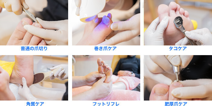 画像: トータルフットケア（～100分）【料金】¥13,200（税込） フットバス・爪ケア・たこケア・うおのめケア・角質ケア（かかと）・フットリフレor足つぼ 上記の中から気になる部分を集中ケア