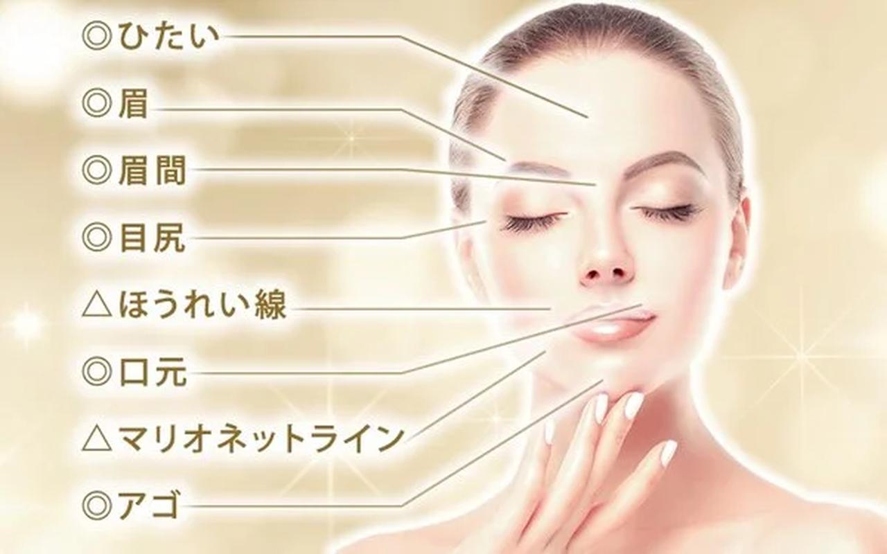 画像: ボトックスビスタ®の向いている部位 * ひたいのしわ・たるみ　* 眉のしわ・たるみ　* 眉間のしわ・たるみ　* 目尻のしわ・たるみ * 口元のしわ・たるみ　* アゴ(あごの梅干しじわなど)