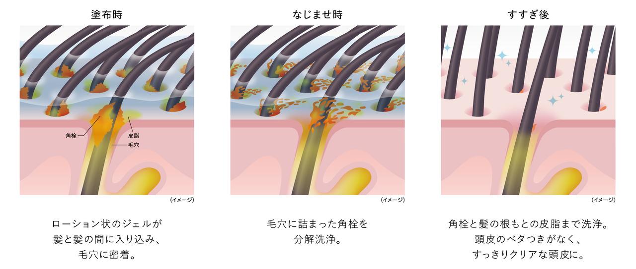 画像2: ●蓄積した頭皮角栓を分解する“角栓洗浄技術”を採用