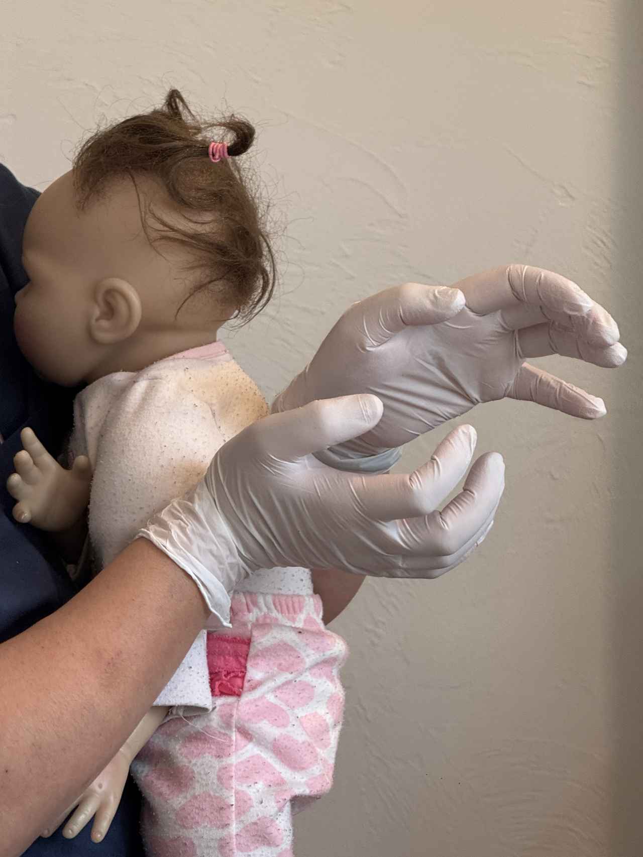 画像: 上下のかみ合わせがぐっとかわってしまう