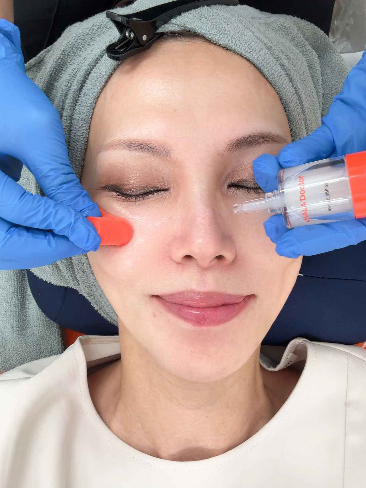 画像6: 韓国の技術と価格♡最新韓国美容が新宿で【AB美容クリニック新宿院】