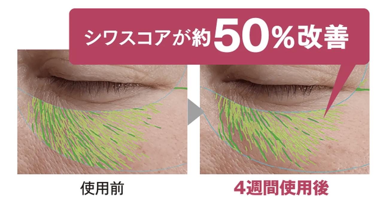 画像: 目元の悩みは、印象の悩み