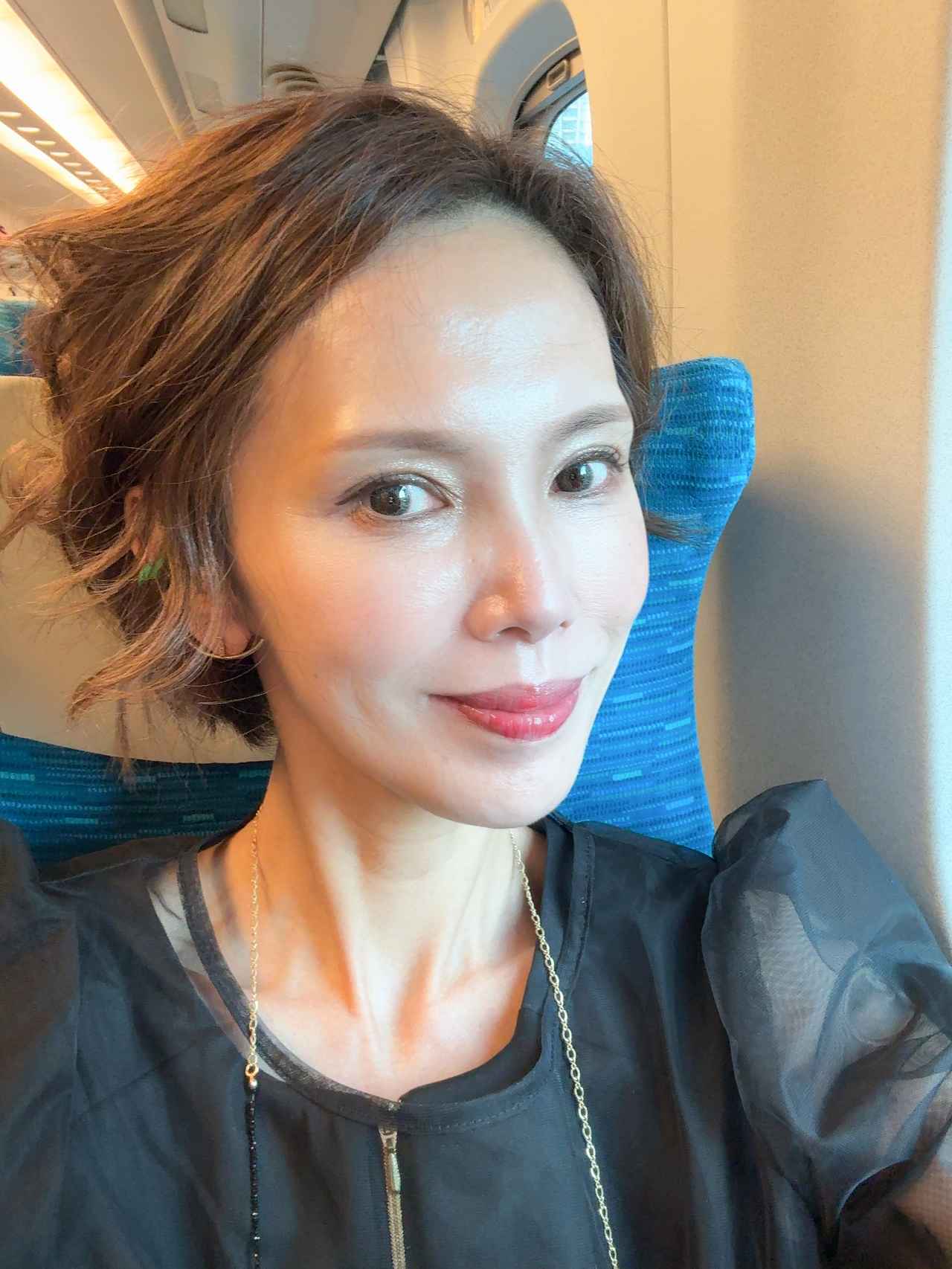 画像11: 1回で効果を実感♡悩みに寄り添うBBLs治療!表参道「TIクリニック」で美しさの再生体験を