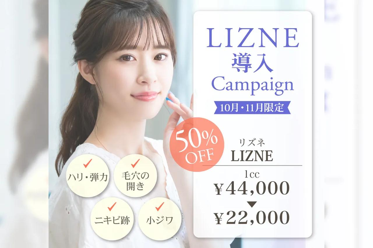 画像8: “目元と肌印象”を整えるナチュラル美容医療体験♡【東京美容クリニック】で「リジュランアイ」と「スキンボトックス」を体験