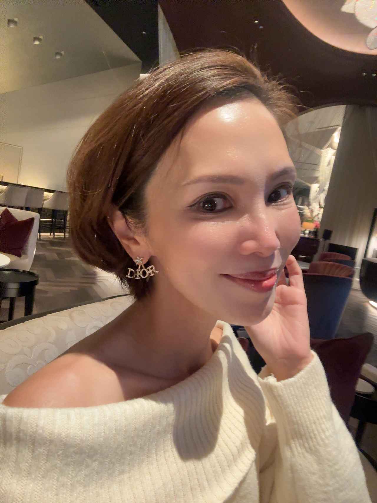 画像: 施術7日後・肌ツヤを褒められる毎日です。