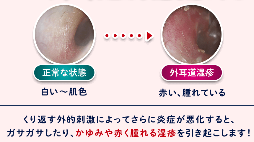 画像2: “花粉耳”でも半数が直接かく対処。4割以上が“かきすぎ”を自覚