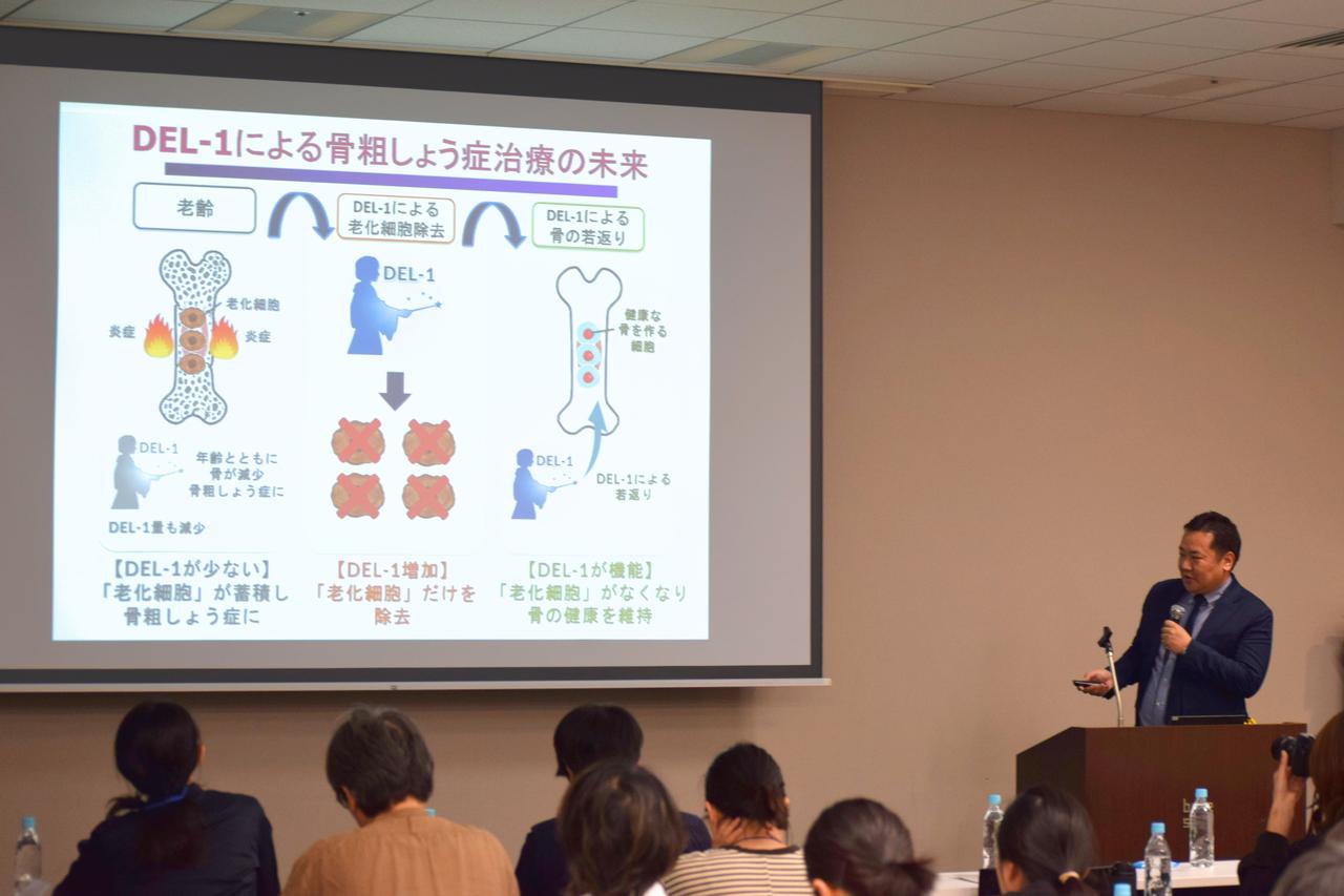 画像1: 常識を覆す「骨の若返り」　骨粗しょう症は“治る”時代へ