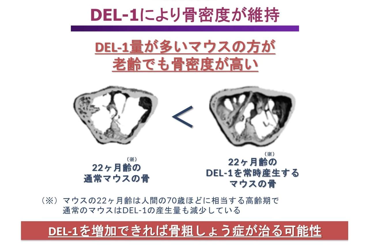 画像2: 常識を覆す「骨の若返り」　骨粗しょう症は“治る”時代へ