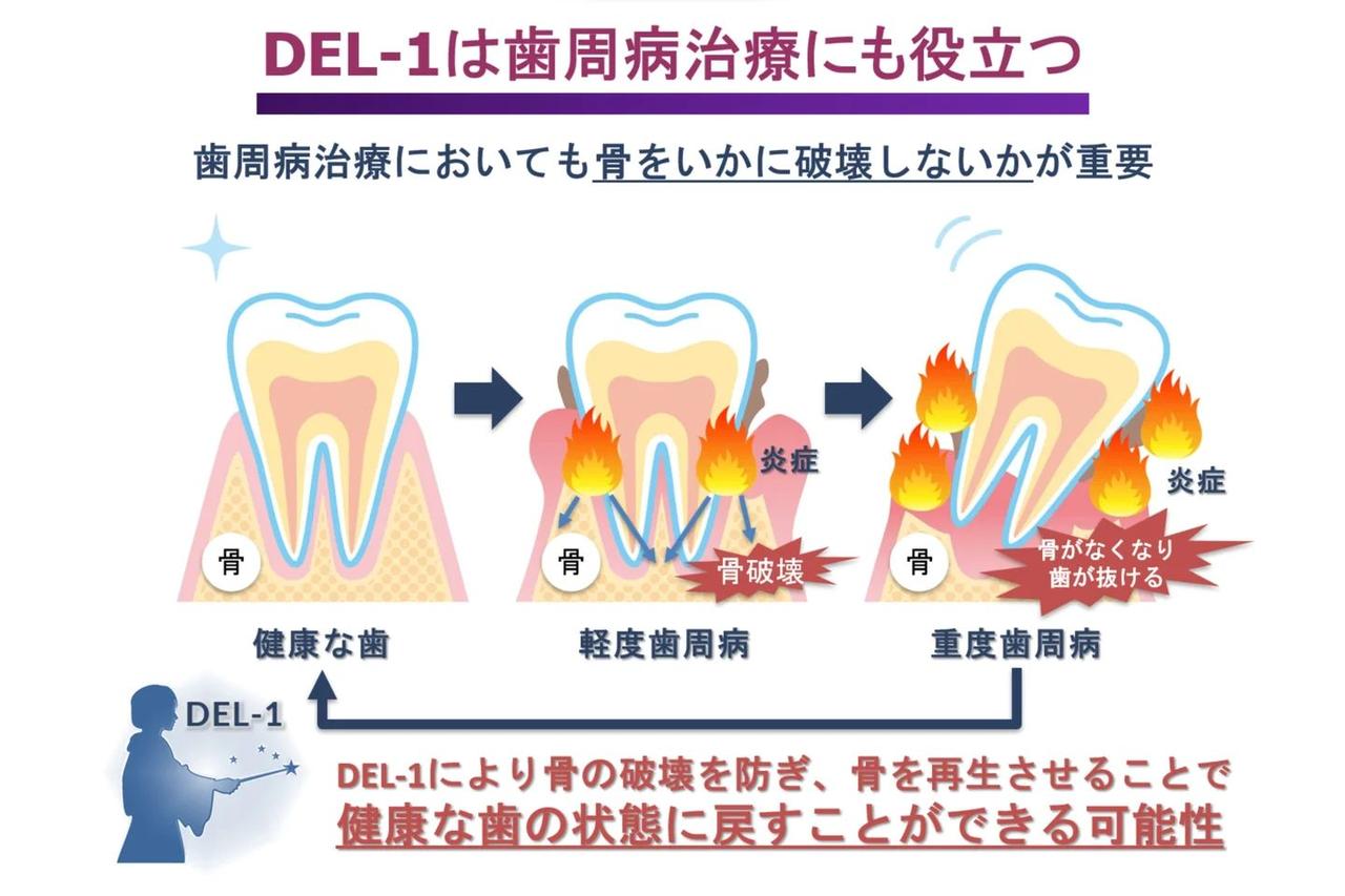 画像2: 美肌も口元の自信も叶える♡ 内側から輝く「DEL-1」の美容パワー