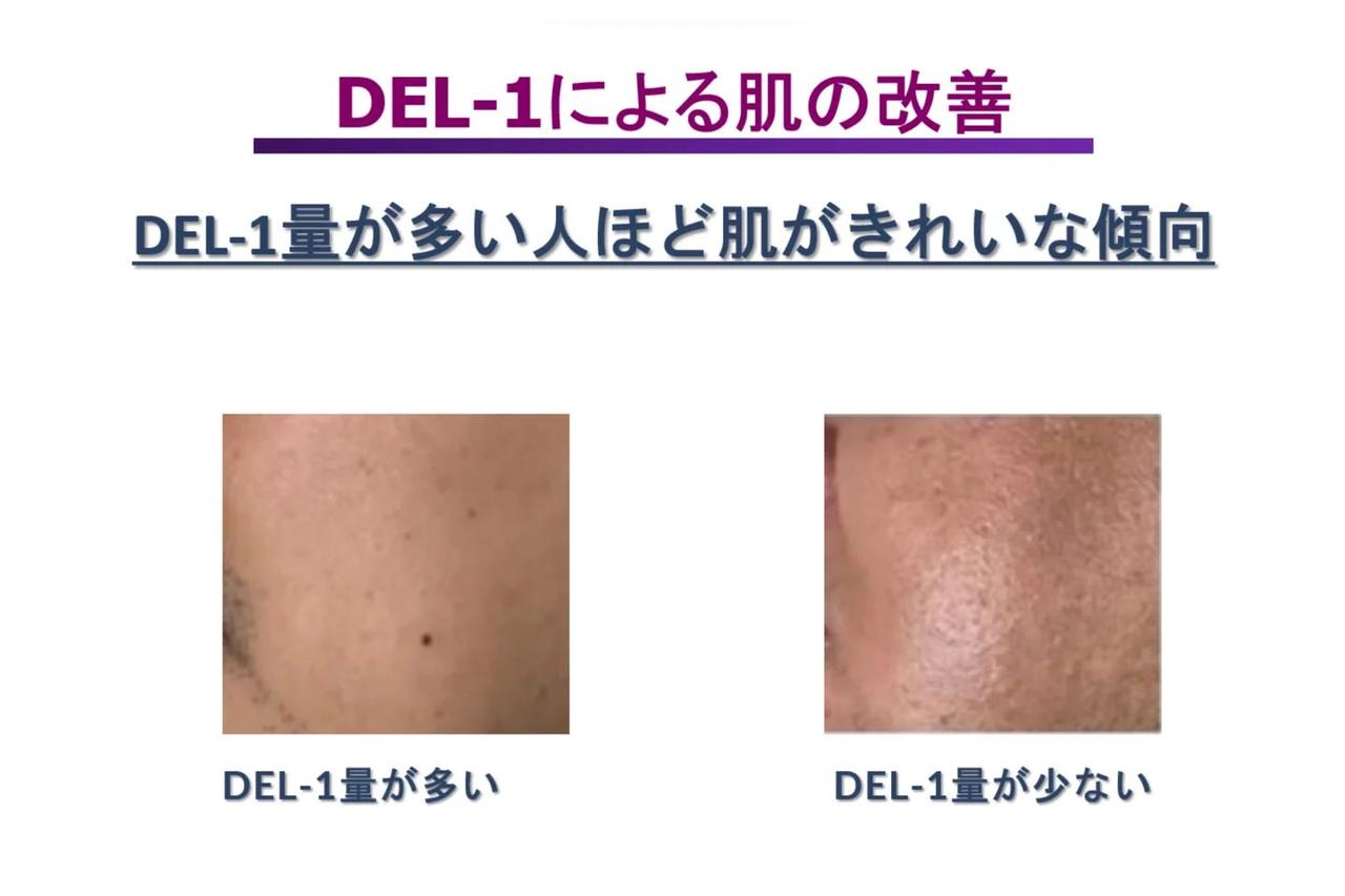 画像1: 美肌も口元の自信も叶える♡ 内側から輝く「DEL-1」の美容パワー