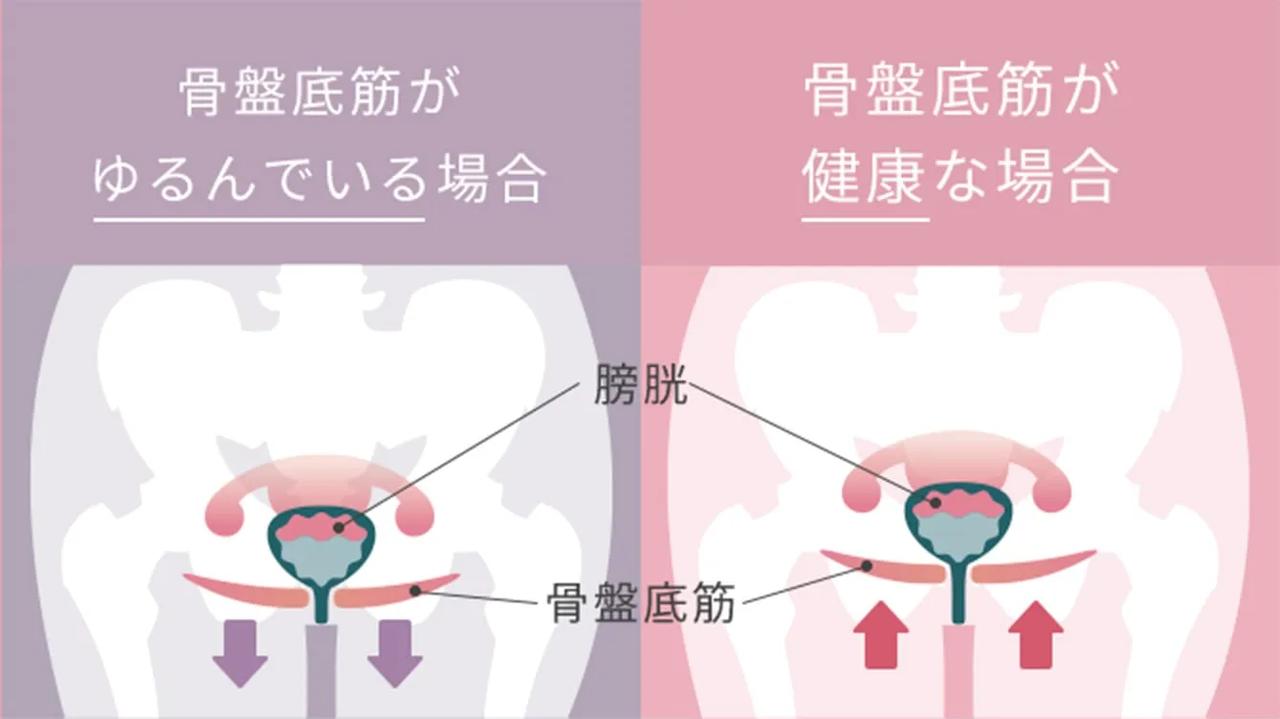 画像3: “はくだけケア”を叶える、やさしいリフトアップ構造