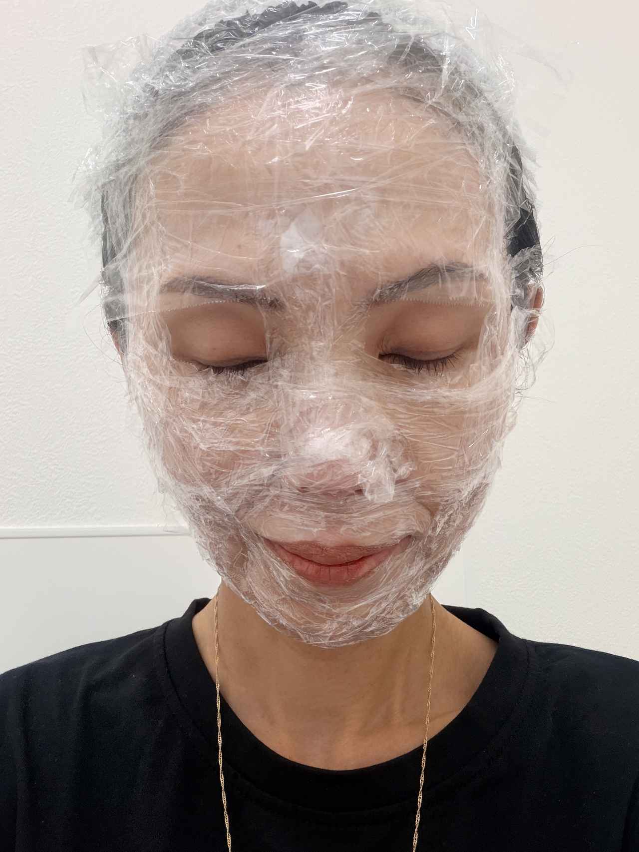 画像2: 【体験レポート】素肌が変わる予感♡リゼクリニックで受けた美容医療の新定番“ドラッグデリバリーポテンツァ”