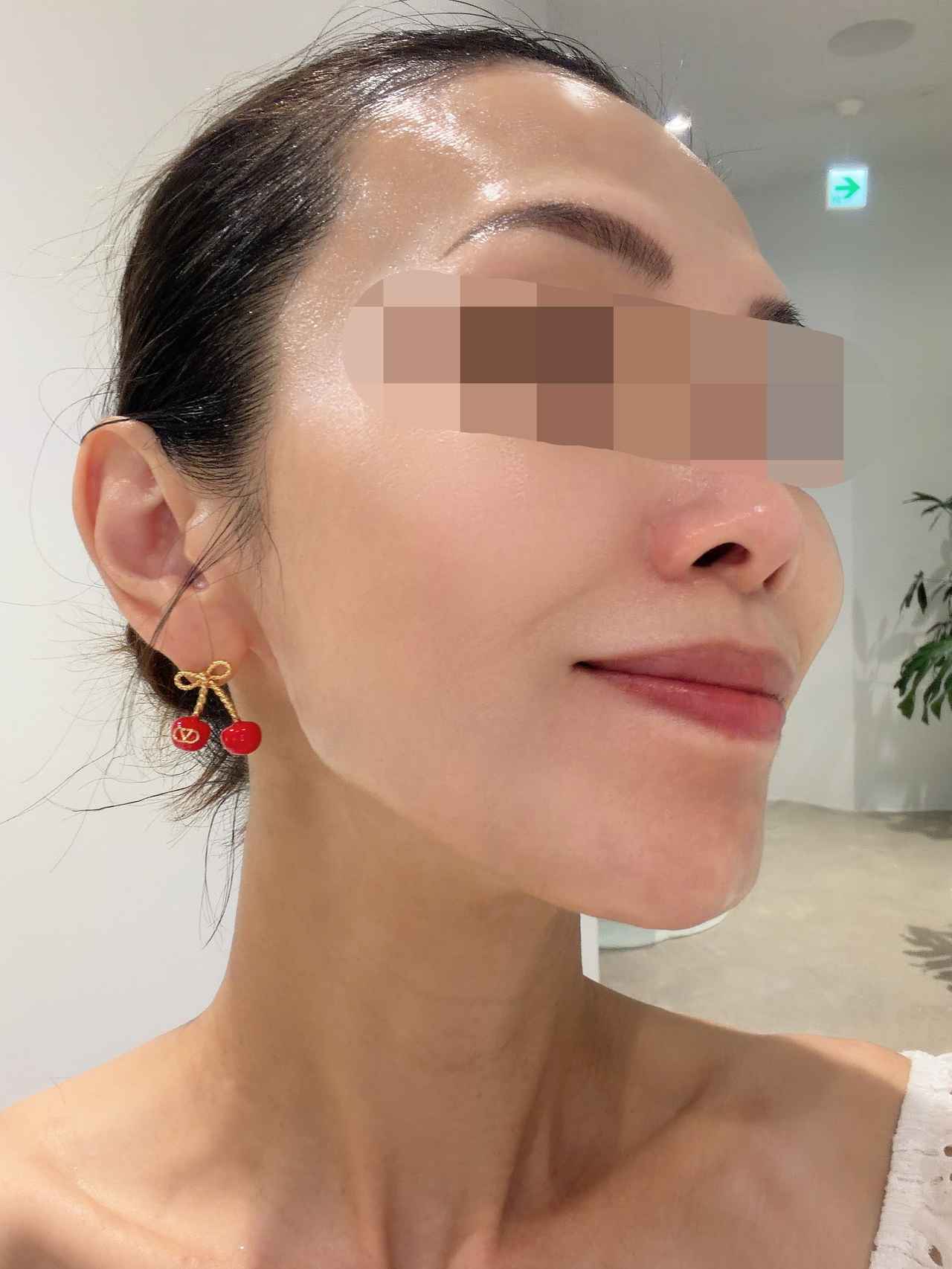 画像16: 心と体の「潜在美意識」を呼び覚ます♡ポーラが贈る新トータルケアサービス「リセンスエステ」を体験