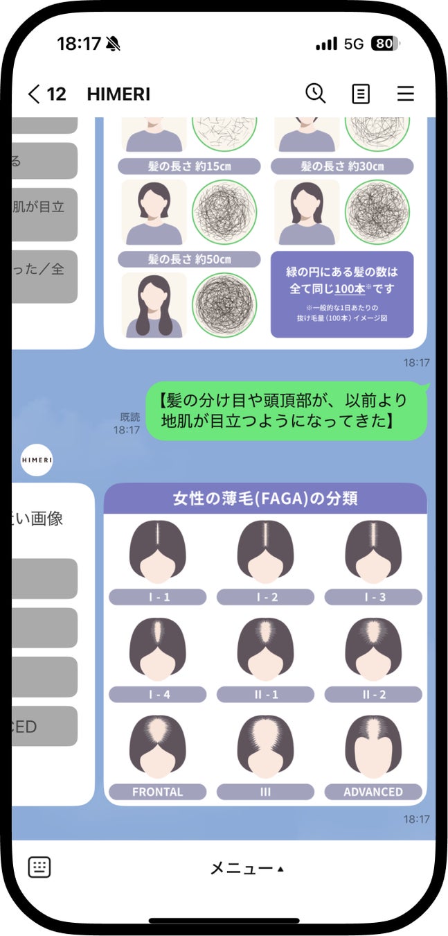 画像2: 女性用発毛剤「ヒメリ ミノキ1%」が登場。ミノキシジル1%配合でオンライン購入にも対応