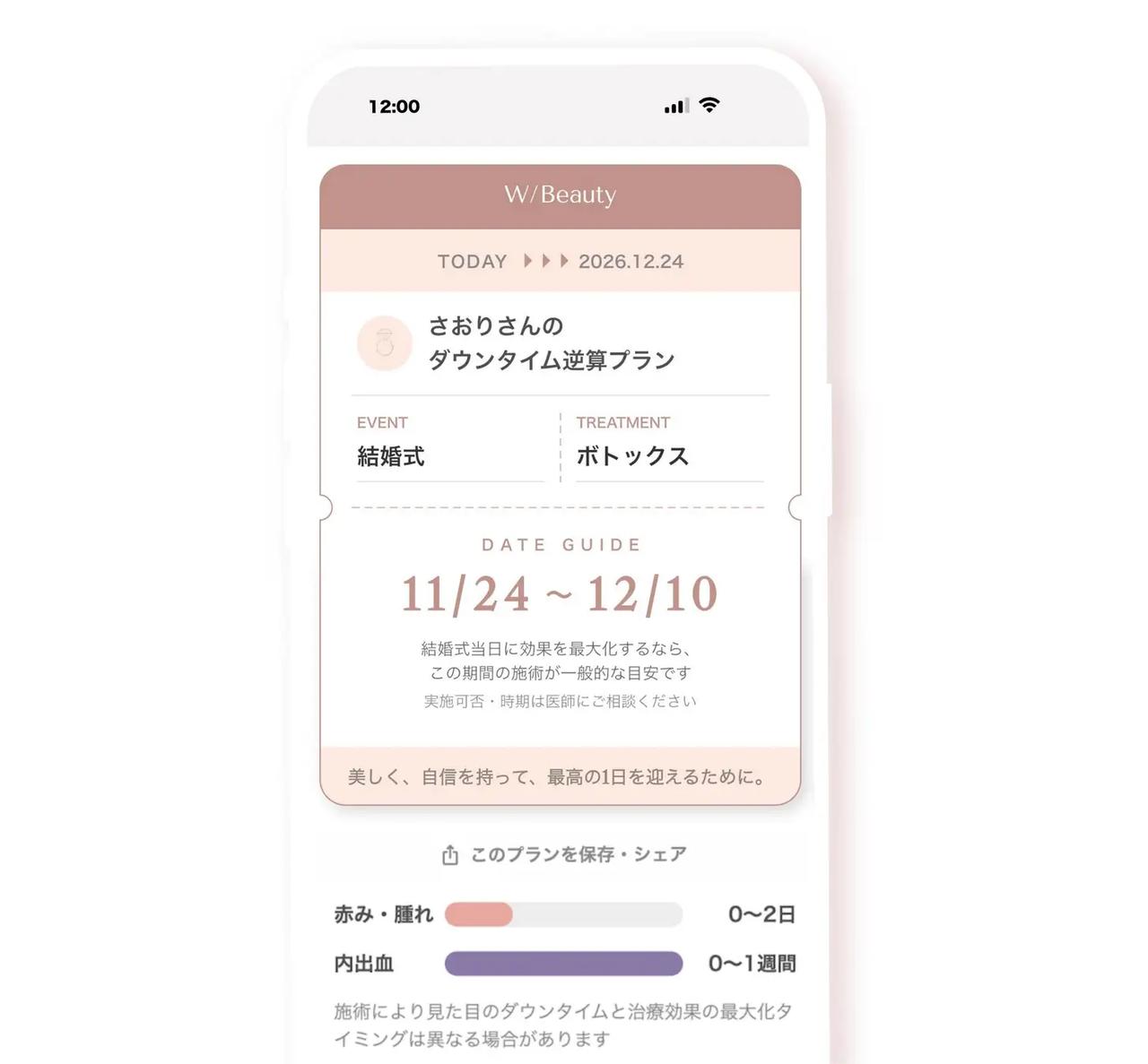 画像: 図:ダウンタイム逆算プランナーイメージ