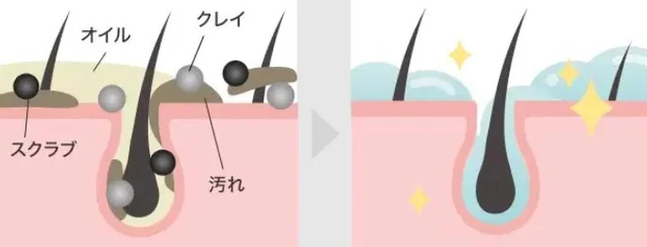 画像: 【新発想】ナイアシンアミド弾ける♡『レチスパ』で叶える大人のツヤさら髪管理