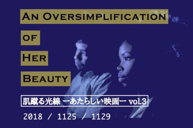 画像: 肌蹴る光線