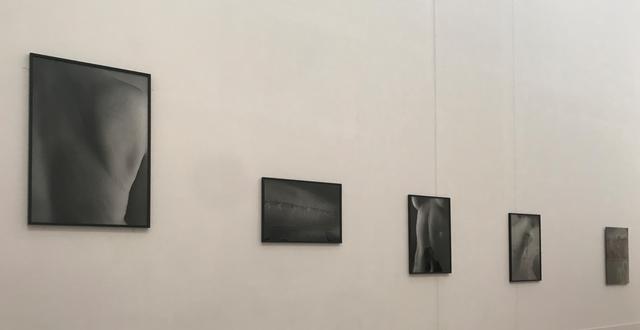 画像: 「プロローグ-身体と風景」 展示風景:石内都 《「Scars」シリーズ 》 photo©saitomoichi