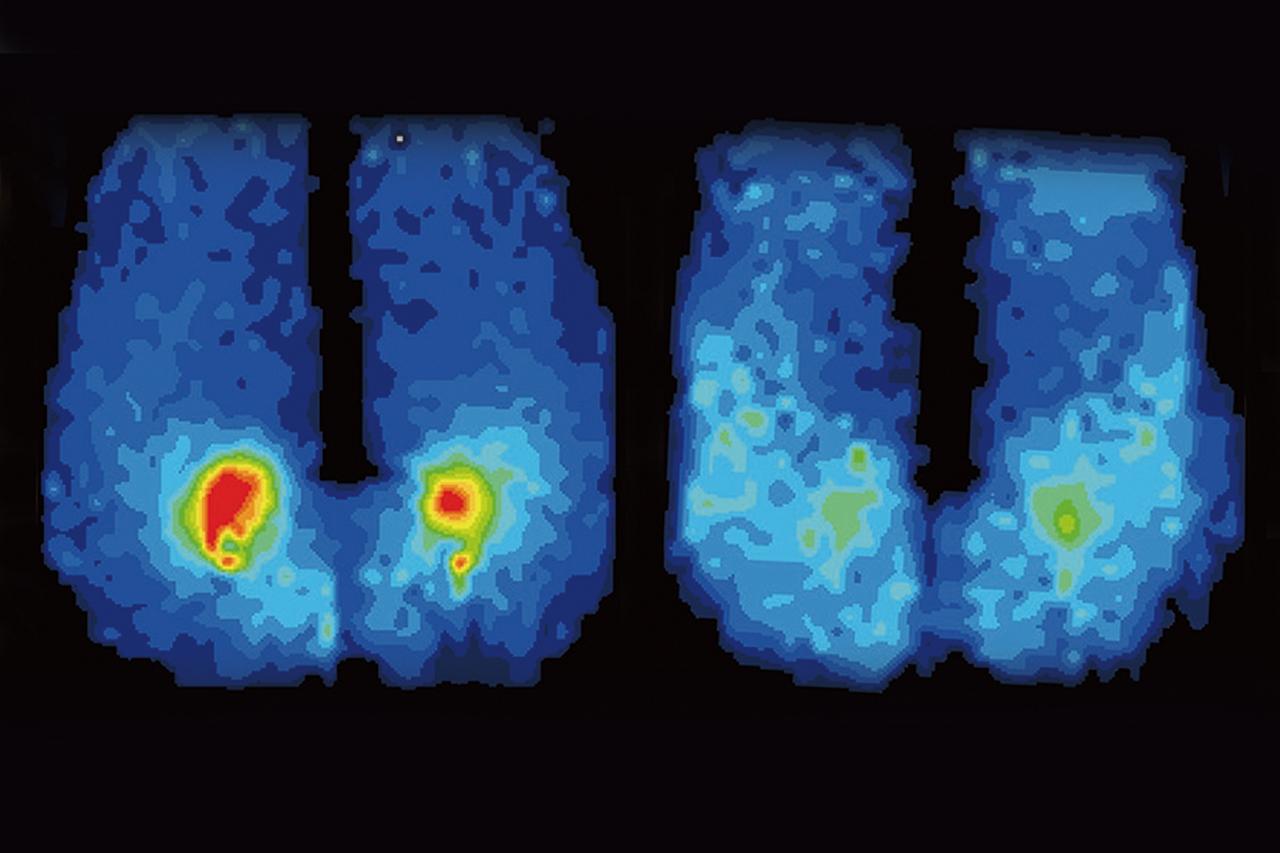 画像3: プロト「ゲルザブ mocch（もっち）」