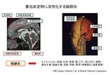画像1: 社会的価値を生み出す「報酬系」の役割