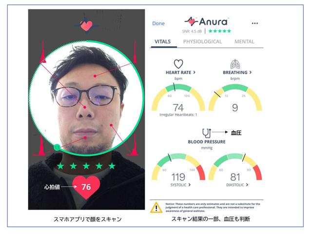 画像2: リモート患者モニタリング
