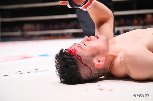 画像2: ROUND 1