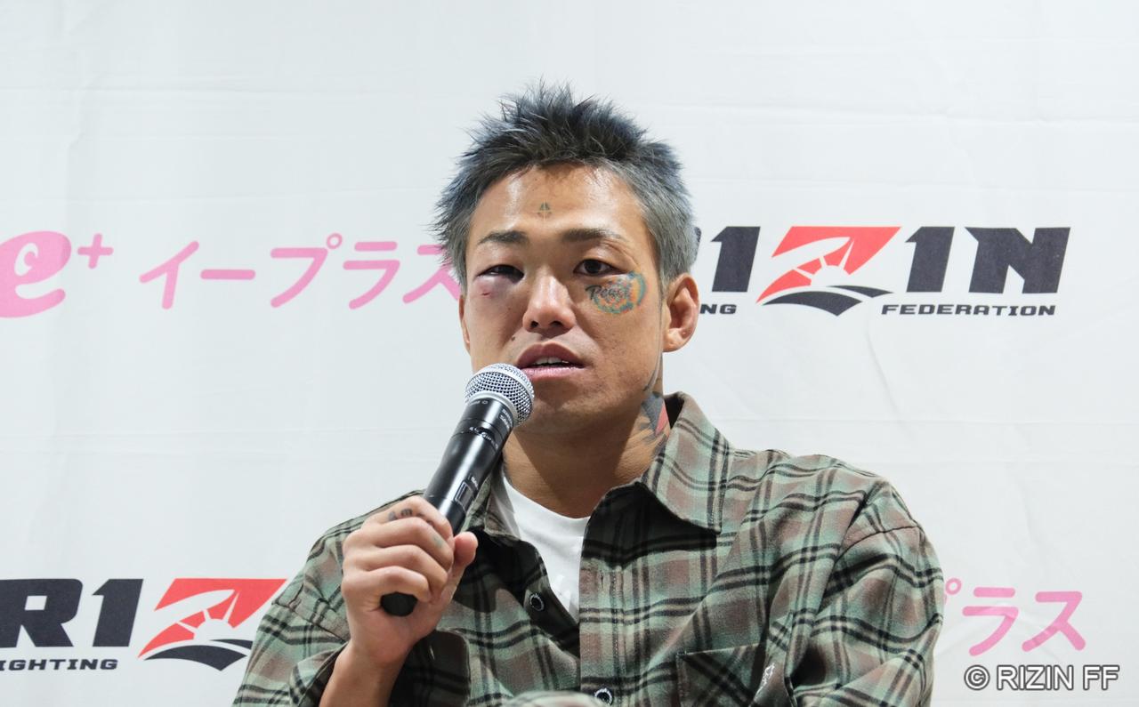 画像1: 芦澤竜誠「またやるだけですね。別に」