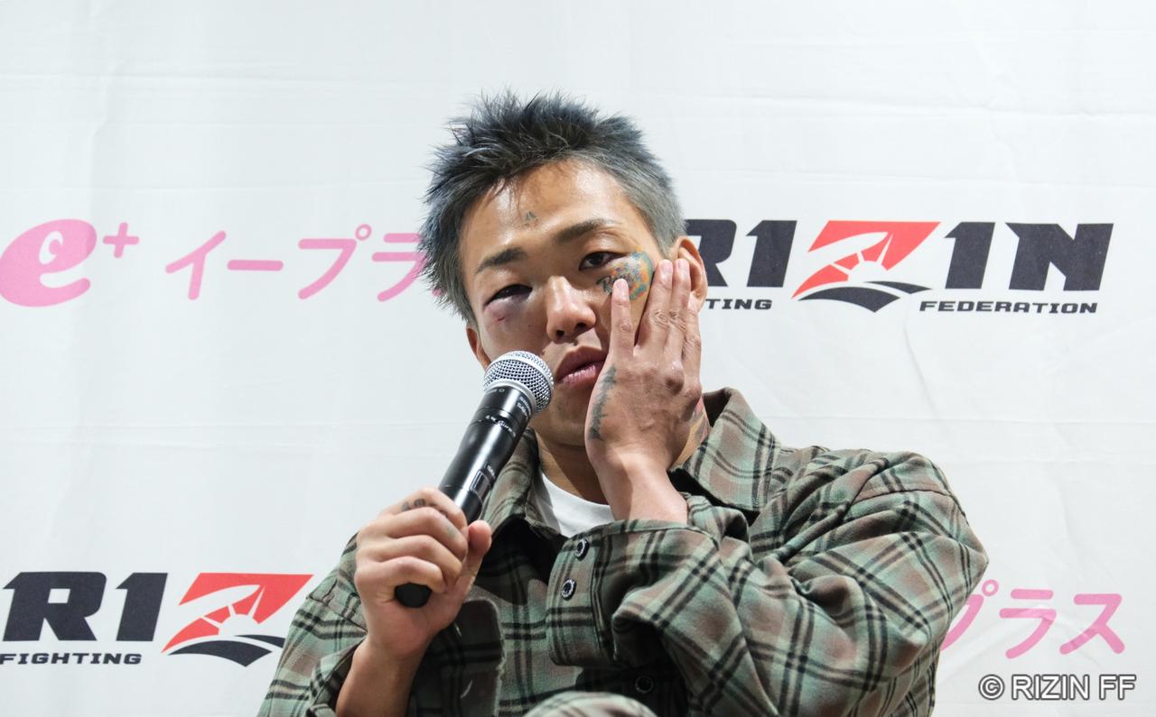 画像2: 芦澤竜誠「またやるだけですね。別に」
