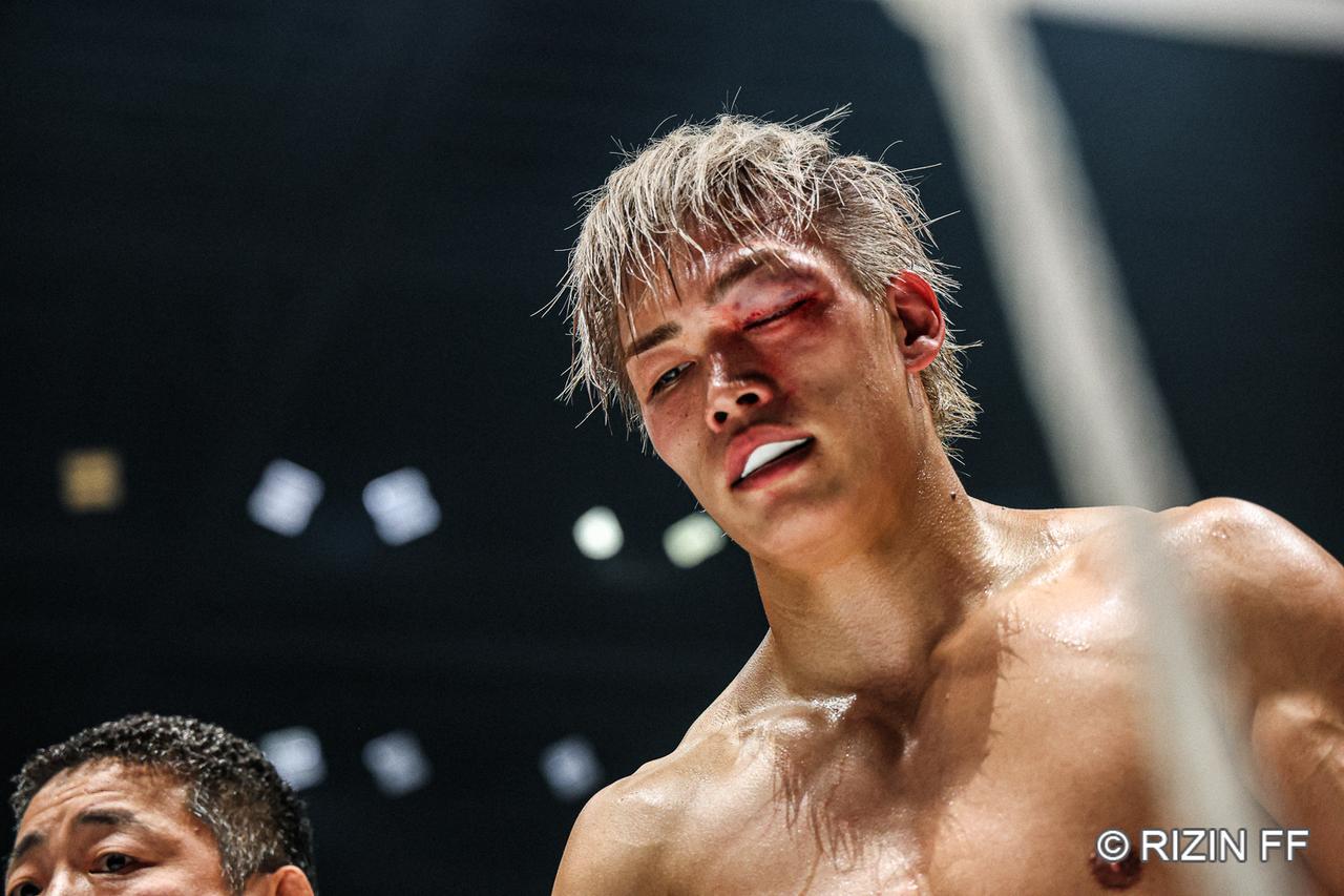 画像3: ROUND 2