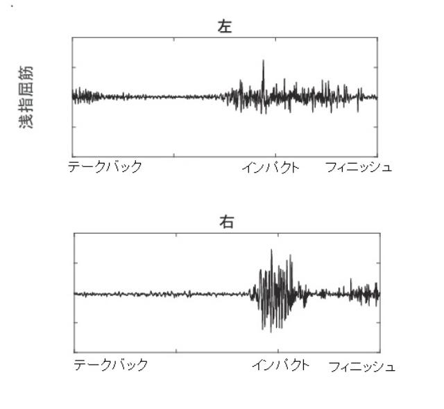 画像: 筋肉はセンシングしている
