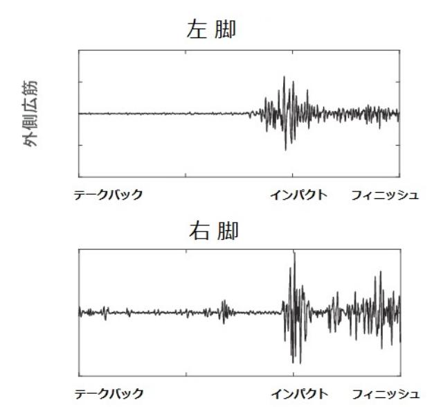 画像: ひざを伸ばす時に使う筋肉