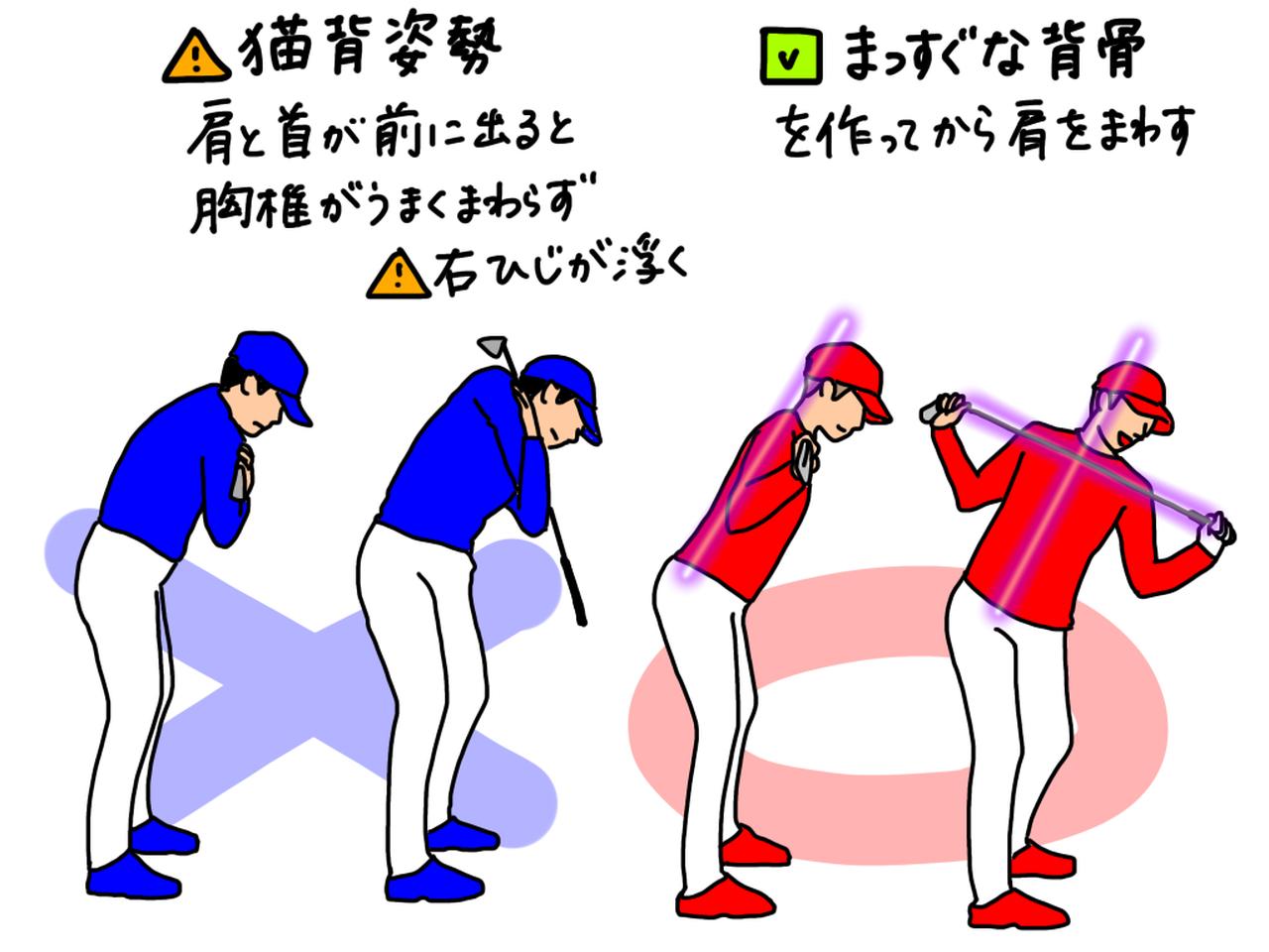 画像: イラストB：猫背だと首と肩が前に出て、胸椎がうまく回らない。回転が制限されることで、右ひじを浮かせる代償動作が起こってしまう