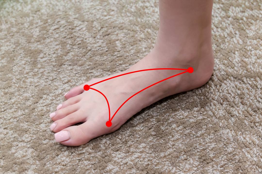 画像: 上がり3ホールで大叩きする原因は足裏にあり!? 女子プロも愛用する機能性インソールでゴルフの疲労を激減